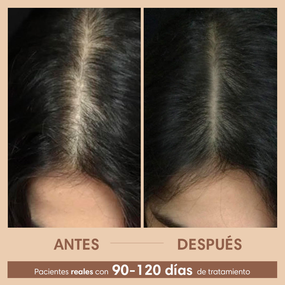 Sérum Capilar Densificador