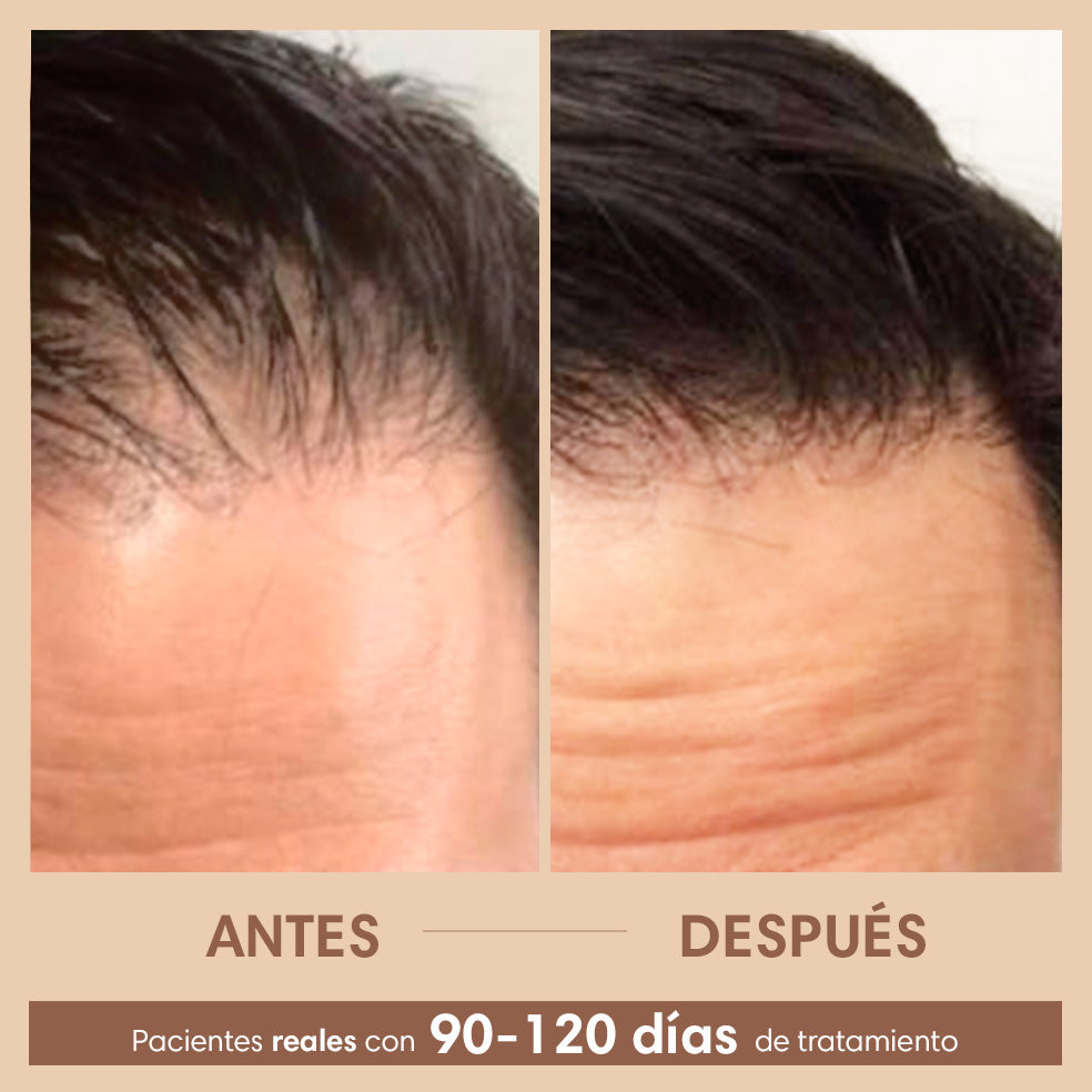 Sérum Capilar Densificador