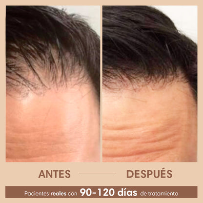 Sérum Capilar Densificador